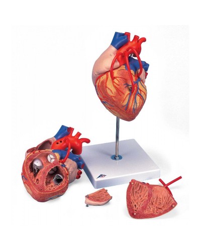 Heart with Bypass, 2 times life size, 4 part